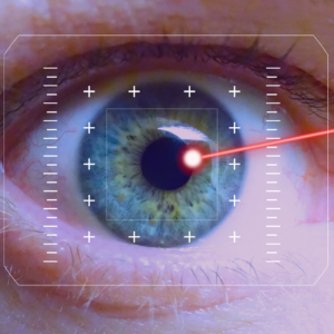 Effects of UV Radiation on the Eye