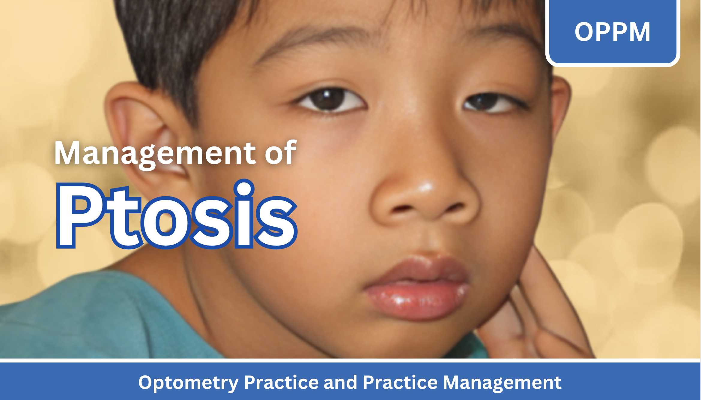 Read more about the article The Management of Ptosis